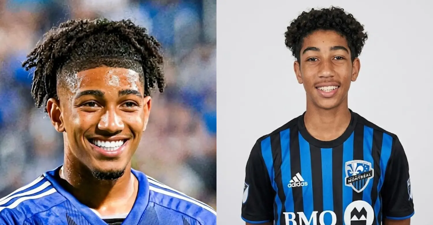 Nathan Saliba teeth